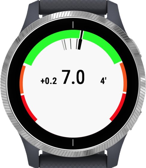 CGM Gauge Datafield captura 4